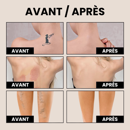 Perfecteur Corps